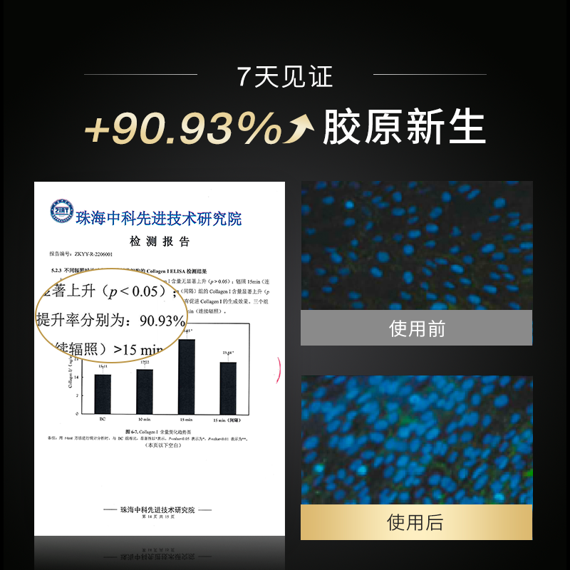 AMIRO觅光胶原炮美容仪器家用脸部提拉紧致嫩肤S1盖章能量射频仪