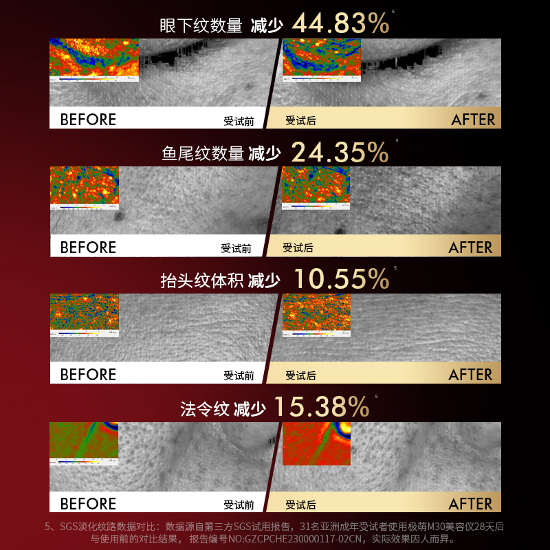 【38抢先购】Jmoon极萌胶原炮Max熨斗美容仪器家用脸部射频提拉